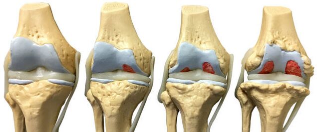 Joint injuries at different stages of development of the ankle joint