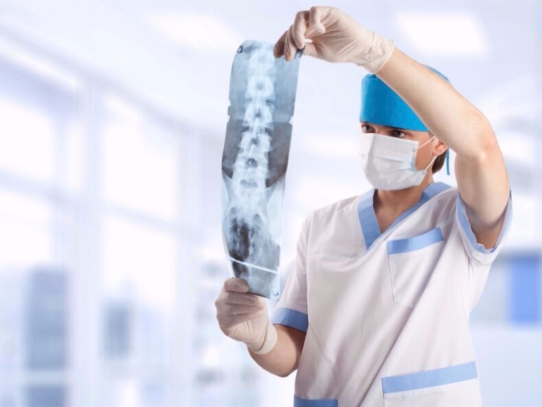 The doctor looks at a snapshot of the cervical spine suffering from osteochondrosis