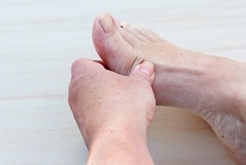Foot joint disease