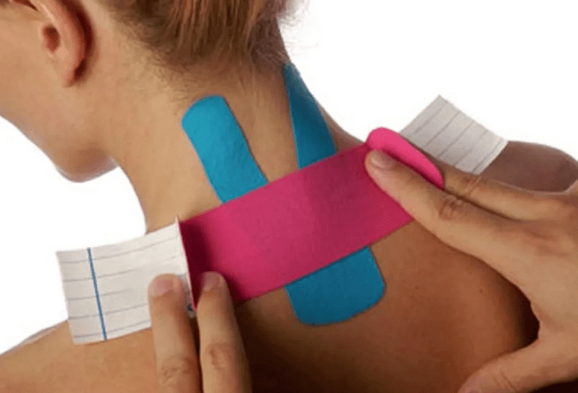 Taping to Treat Neck Pain