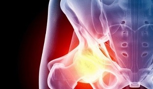 Causes of the development of hip joint disease
