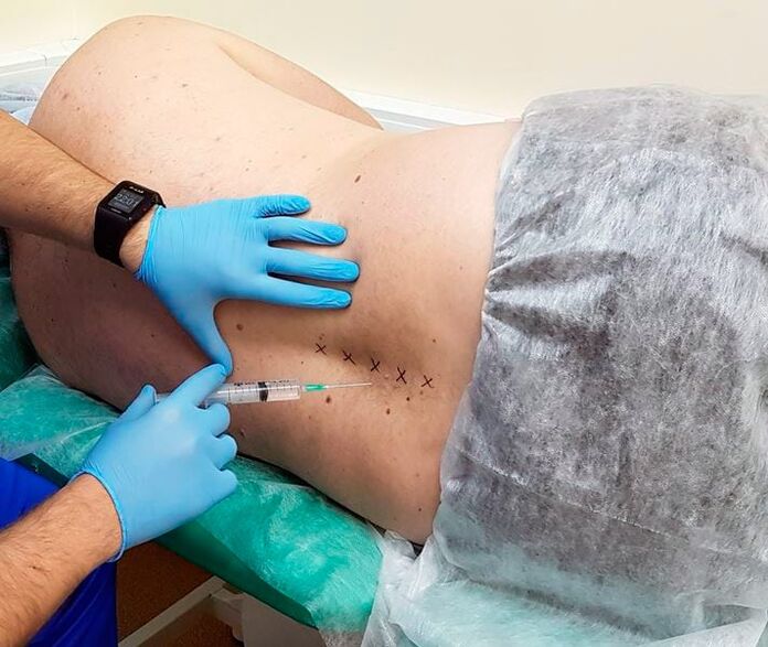 back drug blockade
