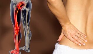 Features of back pain