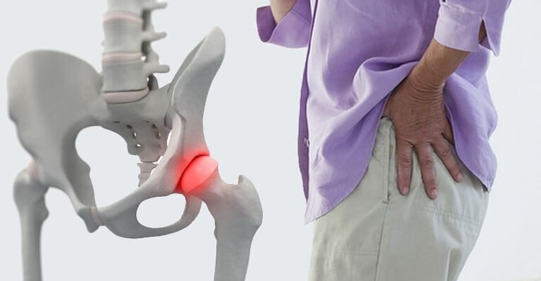 Hip pain-symptoms of hip joint disease